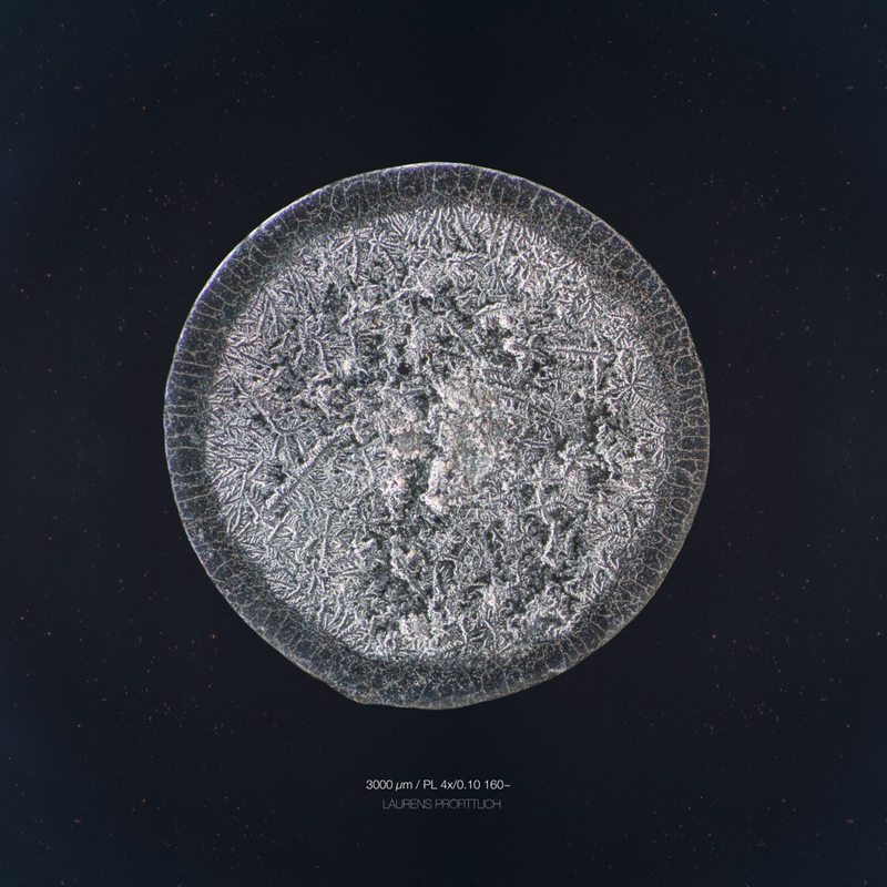 Illustration for article titled The Beautiful Secrets of Tears, Revealed By a Microscope